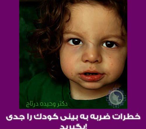 خطرات ضربه به بینی کودک